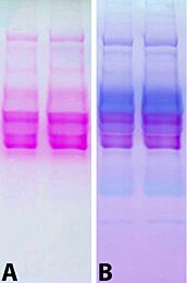 Glycoprotein Staining Kit